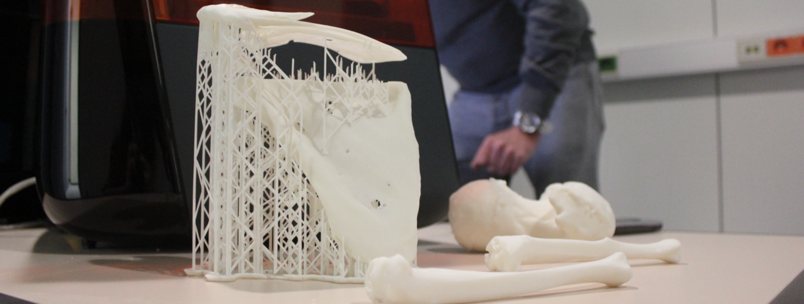 3D-printing optimaliseert orthopedische chirurgie